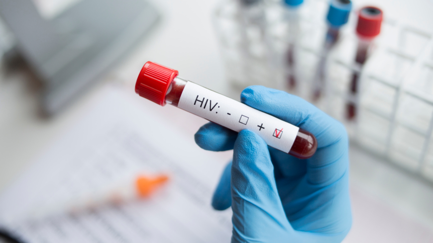 Tillfrisknandet anses vara bevis på att vetenskapen en dag kan bota aids. Foto: Shutterstock